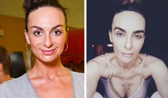 Худо тело, плохо дело: 11 звезд, которые не стали красивее после похудения