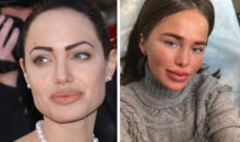 К косметологу не ходи: 9 самых опасных и бесполезных бьюти‑процедур