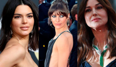 11 звезд, чью внешность портит один крохотный изъян