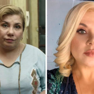 Когда пластика не была лишней: 10 звезд, которые круто преобразились с помощью хирурга