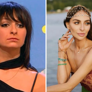 Свое хоть что‑то есть? 10 звезд, которые с пластикой на “ты”