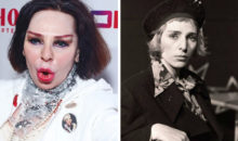 Уже не исправить: 9 наших звезд, которые потеряли красоту из‑за пластики