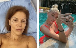 Слепили себе новое лицо и фигуру: 10 звёздных преображений за последнее время