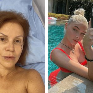Слепили себе новое лицо и фигуру: 10 звёздных преображений за последнее время