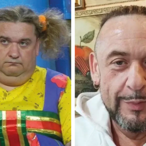 Как похудение меняет лицо – огромная разница на примере 10 звёзд