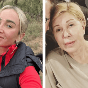 Ни шика, ни блеска: как выглядят настоящие лица 10 звёзд вне камер