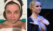 Печальный бюст, плохая кожа: 10 звёзд с заметными изъянами внешности