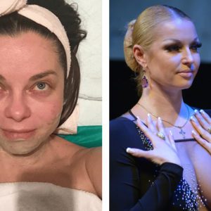 Печальный бюст, плохая кожа: 10 звёзд с заметными изъянами внешности
