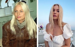 Восхищают переменами: 10 звёзд, которым пластика и похудение пошли на пользу