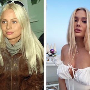 Восхищают переменами: 10 звёзд, которым пластика и похудение пошли на пользу