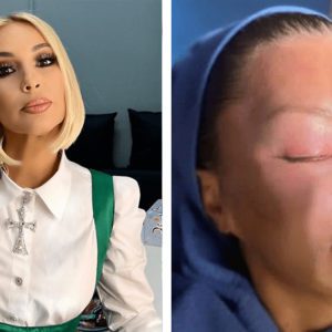 Звёздные «переделки»: 5 удачных и 5 провальных преображений