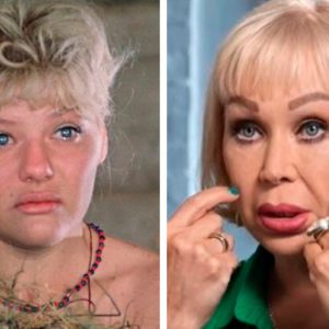 Роман с маньяком и дырявые щеки: 10 постыдных секретов звезд