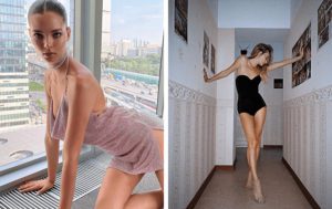 Ещё чуть-чуть, и останется только скелет: 10 слишком худых звёзд