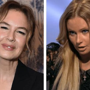 Лицо “поехало” от алкоголя, новый бюст не прижился: 10 ошибок звезд, испортивших их внешность