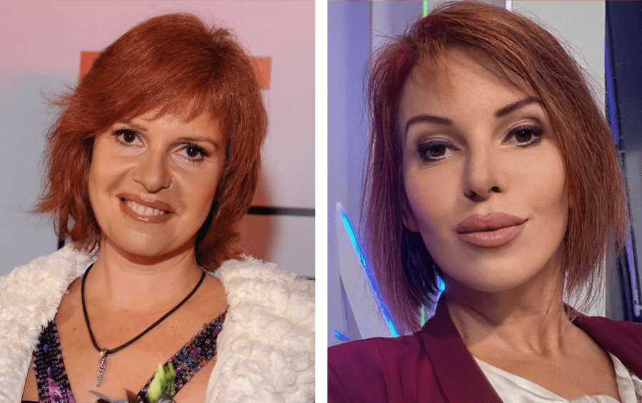 Фото: teleprogramma.pro Миллионы на "лицевой" счет: 10 звёзд, "отваливших" за пластику бешеные деньги