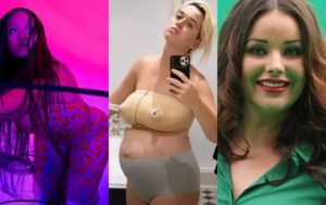 Накладки на грудь и “рыхлый” живот: 8 звёзд честно показали фигуры после родов