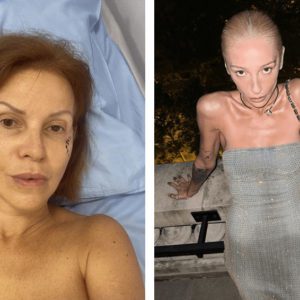 «Разворотили» лицо и тело: 9 звёзд, которым перемены сделали только хуже