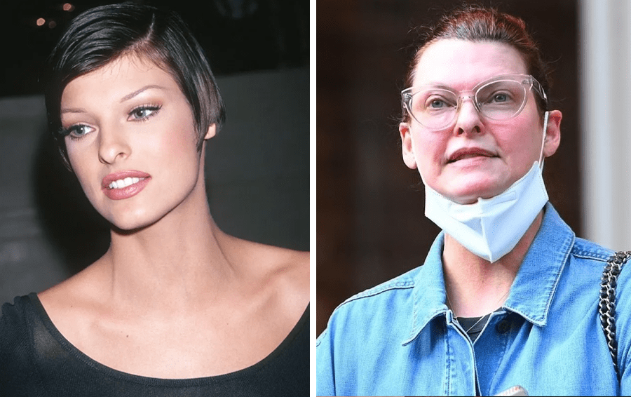 Фото: DR столкнулись с осложнениями пластики