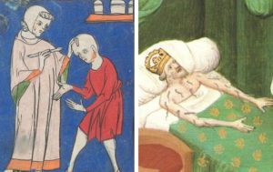 Лечение червём, платья с летальным исходом - 8 "неловких" исторических фактов