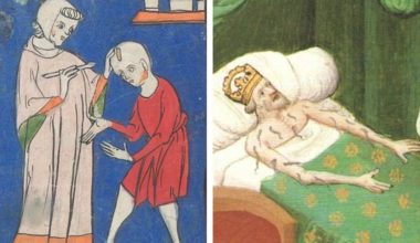 Лечение червём, платья с летальным исходом — 8 «неловких» исторических фактов