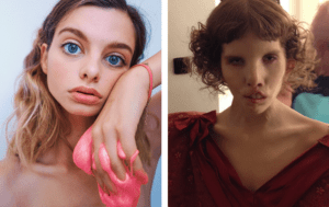 С "причудинкой": 10 обладательниц красивых "изъянов", которым нет равных