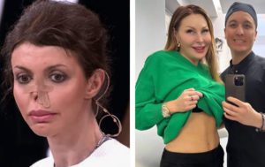 Лишилась носа, перекачала жир: 8 звёзд, чья внешность сильно изменилась