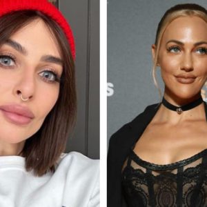 Тюнинг “фасада”: 8 звёзд с переменами на лице — подтяжки, похудение, филлеры