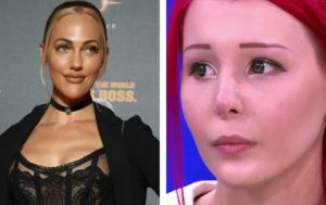 Нормально же было! 10 примеров неудачной пластики лица у звёзд