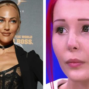 Нормально же было! 10 примеров неудачной пластики лица у звёзд