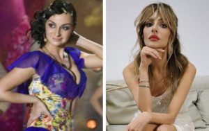 8 звёзд, чья внешность прошла "лютый тюнинг"