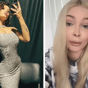 Опять «перешились»: 7 звёзд, которые стали зависимы от пластики