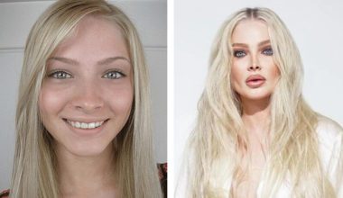 Чрезмерно увлеклись «уколами» и операциями: 7 наших звёзд, переделавших себя — неужели зря?