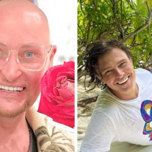 7 звёзд‑мужчин, решивших «навести красоту»: липосакция, нити, виниры и другие преображения