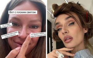 Неудачная пластика груди, зубы за 6 миллионов: 7 звёзд, пустившихся в новые "переделки" внешности