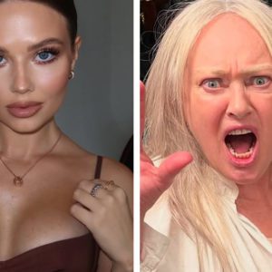 Дыра в щеке, «сполз» имплант в груди : 7 звёзд о красоте и пластике