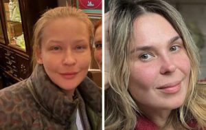 Показали "честные" лица: 8 звёзд, у кого имеются недостатки — и удивившие идеальной кожей