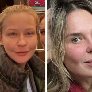 Показали «честные» лица: 8 звёзд, у кого имеются недостатки ‑ и удивившие идеальной кожей