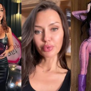 Рискнула лечь под нож и не прогадала: 7 селебрити, ставших «куколками» благодаря операциям