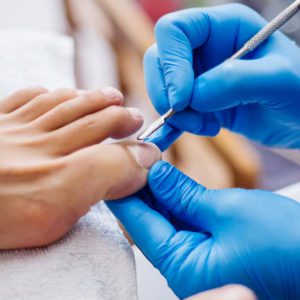 Нет вросшим ногтям и отслойкам: 6 советов для здоровья ногтей