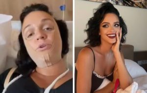 7 звёзд сделали “пластику” и нереально похорошели — вот что значит попался грамотный хирург