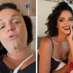 7 звёзд сделали “пластику” и нереально похорошели ‑ вот что значит попался грамотный хирург