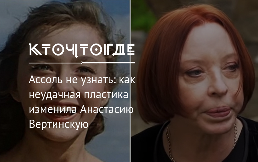 Маслякова таисия пластика лица фото до и после